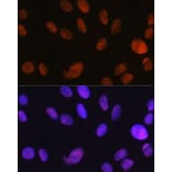 Immunofluorescence - Anti-SNF2H Antibody [ARC0795] (A308440) - Antibodies.com