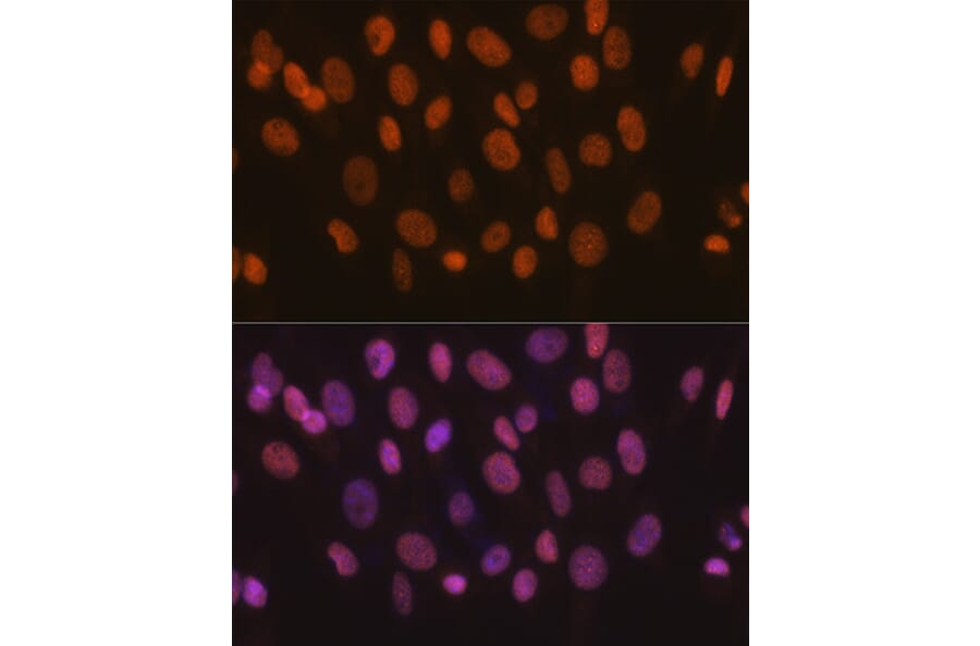 Immunofluorescence - Anti-SNF2H Antibody [ARC0795] (A308440) - Antibodies.com