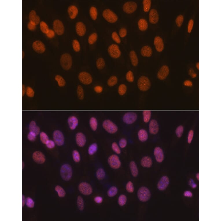 Immunofluorescence - Anti-SNF2H Antibody [ARC0795] (A308440) - Antibodies.com