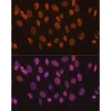 Immunofluorescence - Anti-SNF2H Antibody [ARC0795] (A308440) - Antibodies.com