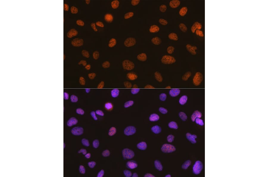 Immunofluorescence - Anti-SNF2H Antibody [ARC0795] (A308440) - Antibodies.com