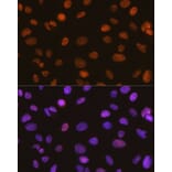 Immunofluorescence - Anti-SNF2H Antibody [ARC0795] (A308440) - Antibodies.com