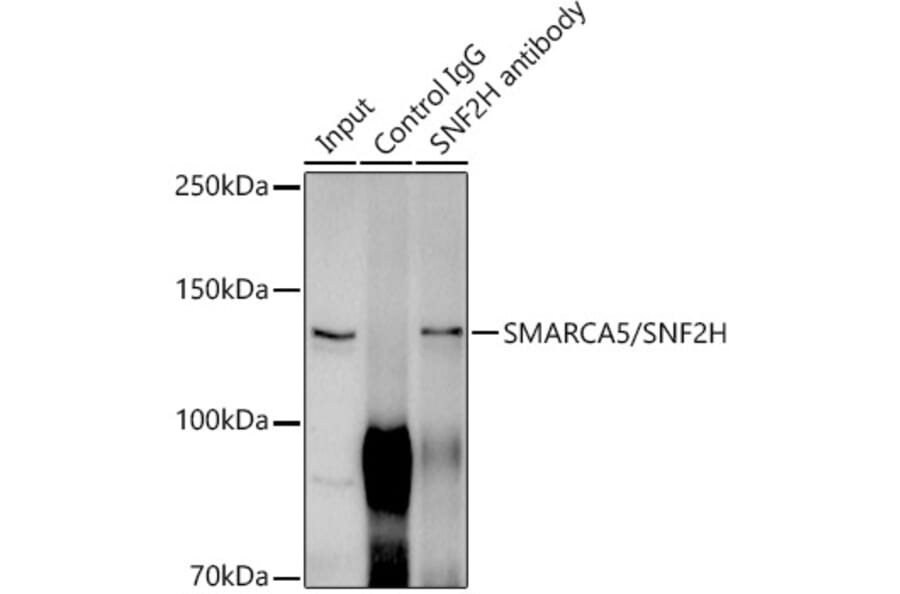 Western Blot - Anti-SNF2H Antibody [ARC0795] (A308440) - Antibodies.com