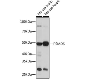 Western Blot - Anti-PSMD6 Antibody (A308441) - Antibodies.com