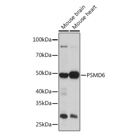 Western Blot - Anti-PSMD6 Antibody (A308441) - Antibodies.com