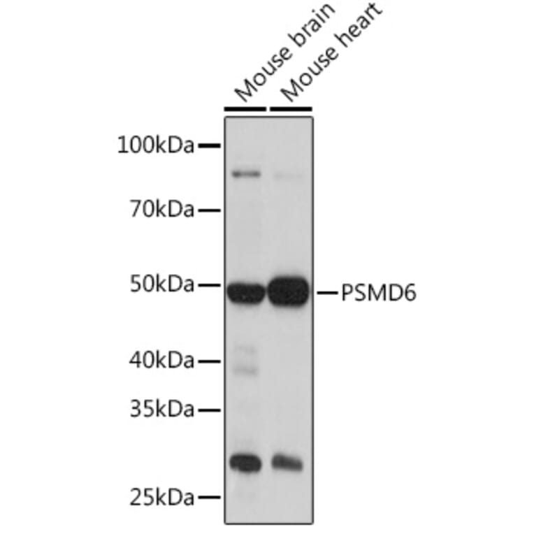 Western Blot - Anti-PSMD6 Antibody (A308441) - Antibodies.com