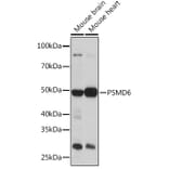 Western Blot - Anti-PSMD6 Antibody (A308441) - Antibodies.com