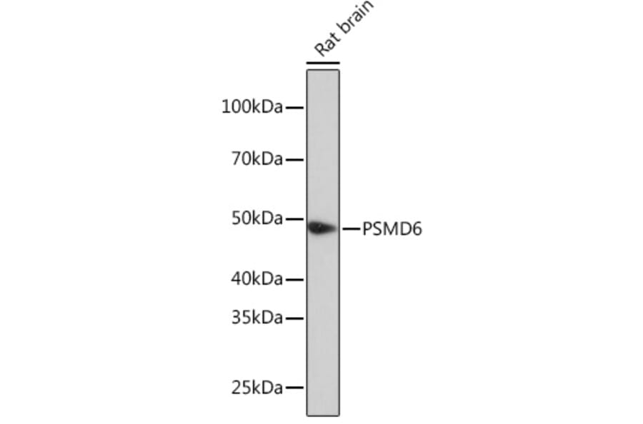 Western Blot - Anti-PSMD6 Antibody (A308441) - Antibodies.com