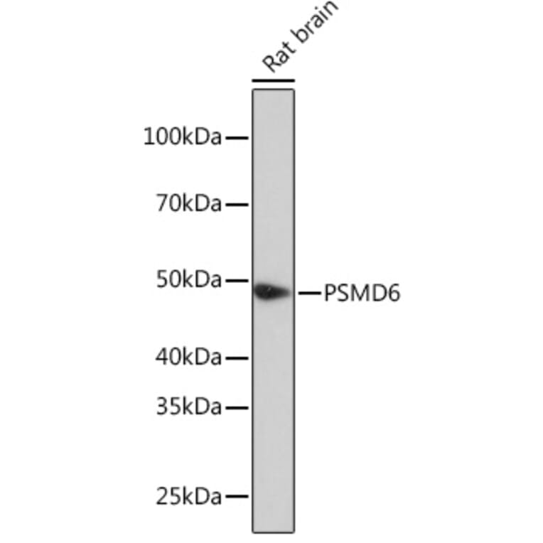 Western Blot - Anti-PSMD6 Antibody (A308441) - Antibodies.com