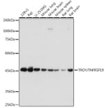 Western Blot - Anti-TROY Antibody [ARC2393] (A308442) - Antibodies.com