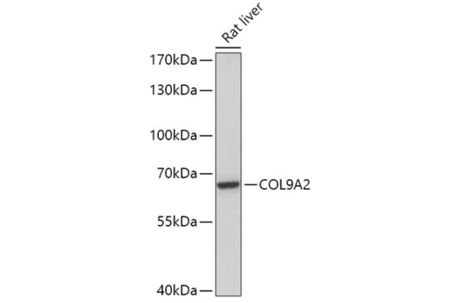 Western Blot - Anti-COL9A2 Antibody (A308443) - Antibodies.com