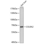 Western Blot - Anti-COL9A2 Antibody (A308443) - Antibodies.com