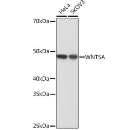 Western Blot - Anti-Wnt5a Antibody [ARC0405] (A308446) - Antibodies.com