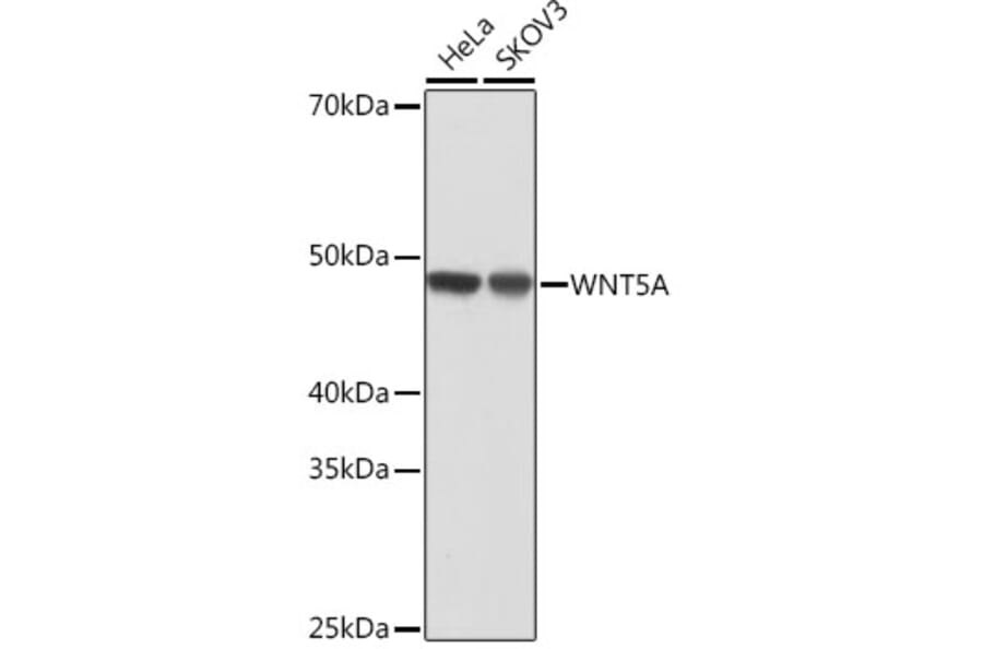 Western Blot - Anti-Wnt5a Antibody [ARC0405] (A308446) - Antibodies.com