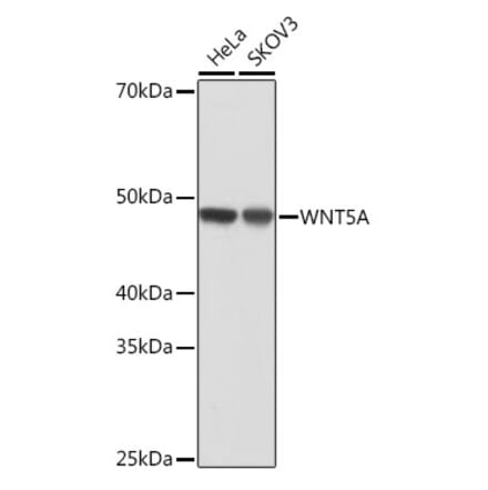 Western Blot - Anti-Wnt5a Antibody [ARC0405] (A308446) - Antibodies.com