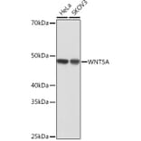 Western Blot - Anti-Wnt5a Antibody [ARC0405] (A308446) - Antibodies.com