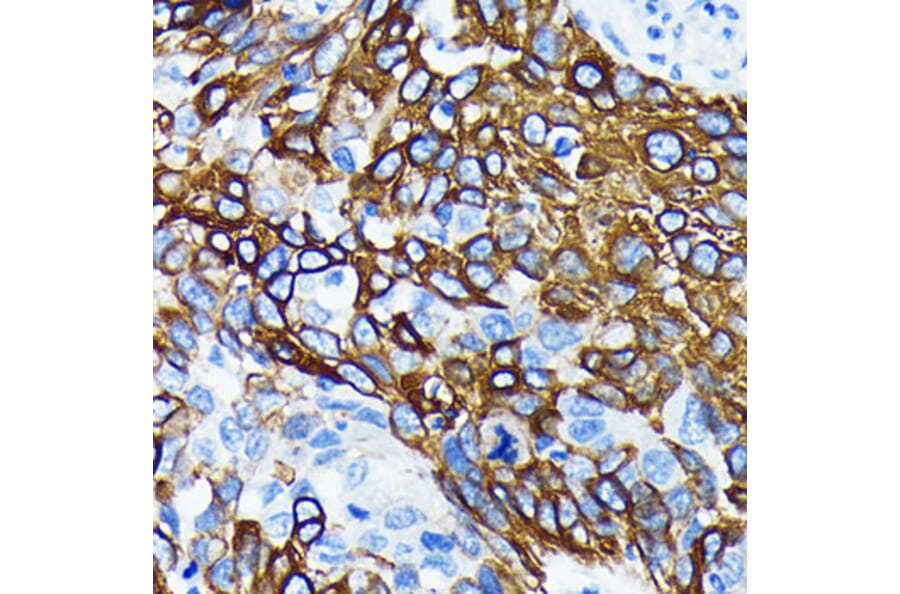 Immunohistochemistry - Anti-Wnt5a Antibody [ARC0405] (A308446) - Antibodies.com