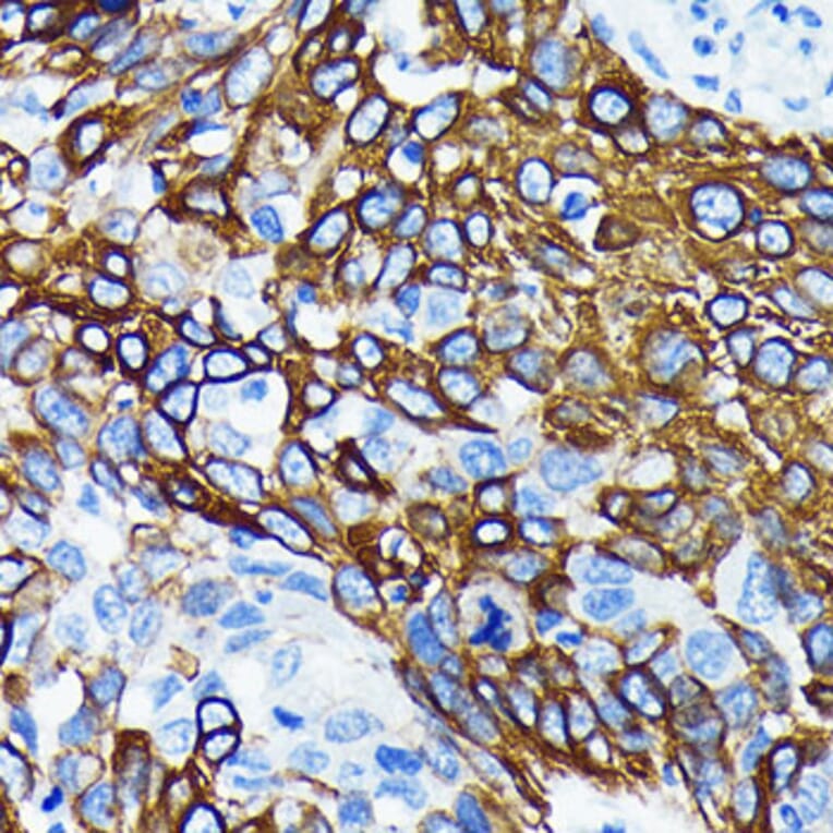 Immunohistochemistry - Anti-Wnt5a Antibody [ARC0405] (A308446) - Antibodies.com