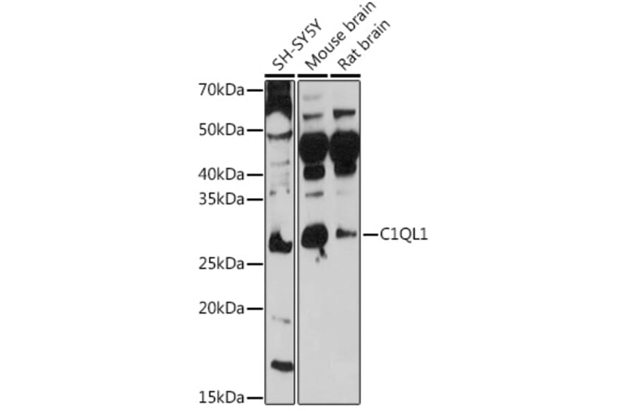 Western Blot - Anti-C1QL1 Antibody (A308447) - Antibodies.com