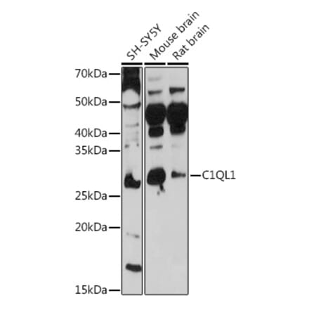 Western Blot - Anti-C1QL1 Antibody (A308447) - Antibodies.com