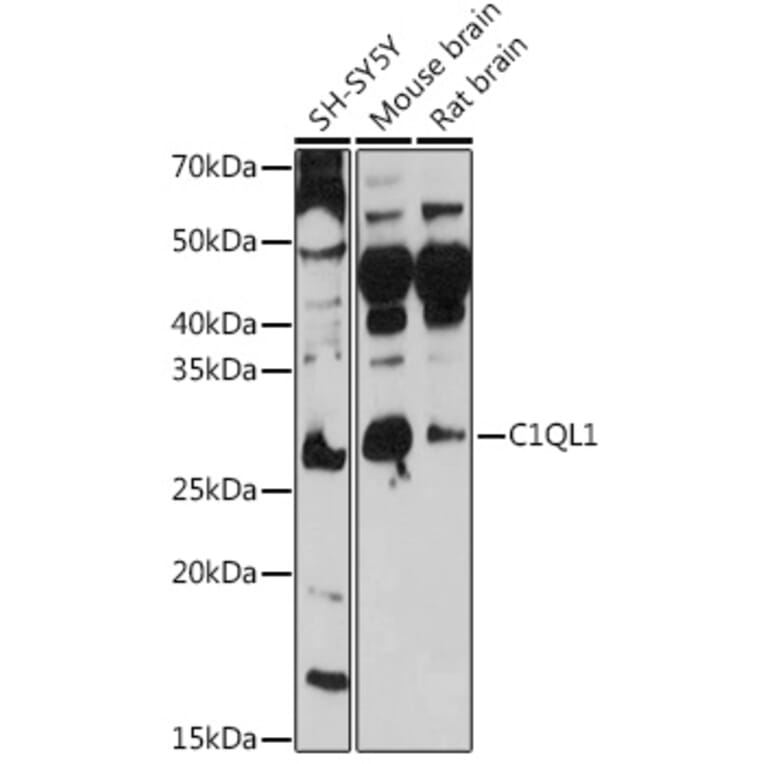 Western Blot - Anti-C1QL1 Antibody (A308447) - Antibodies.com