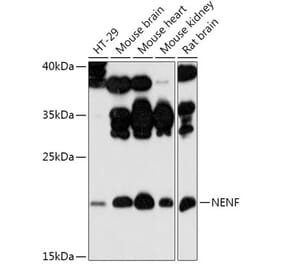 Western Blot - Anti-NENF Antibody (A308448) - Antibodies.com