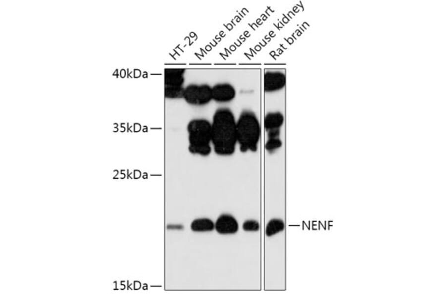 Western Blot - Anti-NENF Antibody (A308448) - Antibodies.com