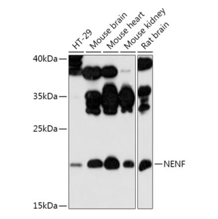 Western Blot - Anti-NENF Antibody (A308448) - Antibodies.com