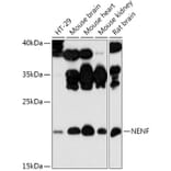 Western Blot - Anti-NENF Antibody (A308448) - Antibodies.com