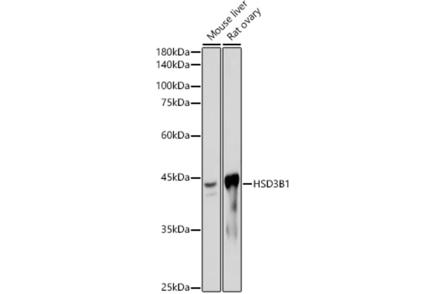 Western Blot - Anti-HSD3B1 Antibody [ARC2437] (A308449) - Antibodies.com