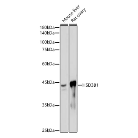 Western Blot - Anti-HSD3B1 Antibody [ARC2437] (A308449) - Antibodies.com