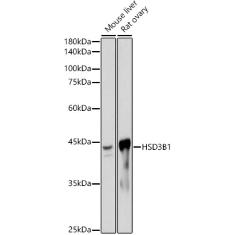 Western Blot - Anti-HSD3B1 Antibody [ARC2437] (A308449) - Antibodies.com