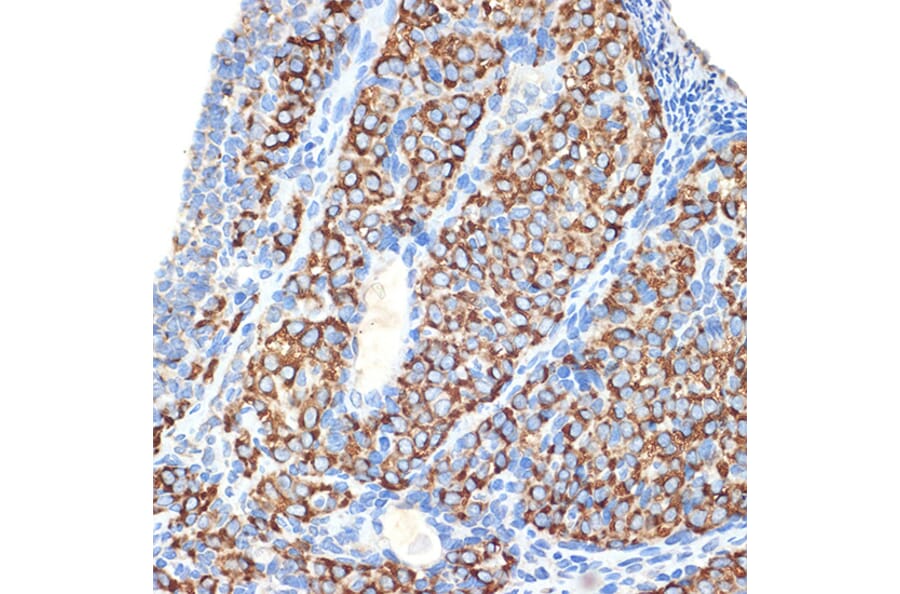 Immunohistochemistry - Anti-HSD3B1 Antibody [ARC2437] (A308449) - Antibodies.com