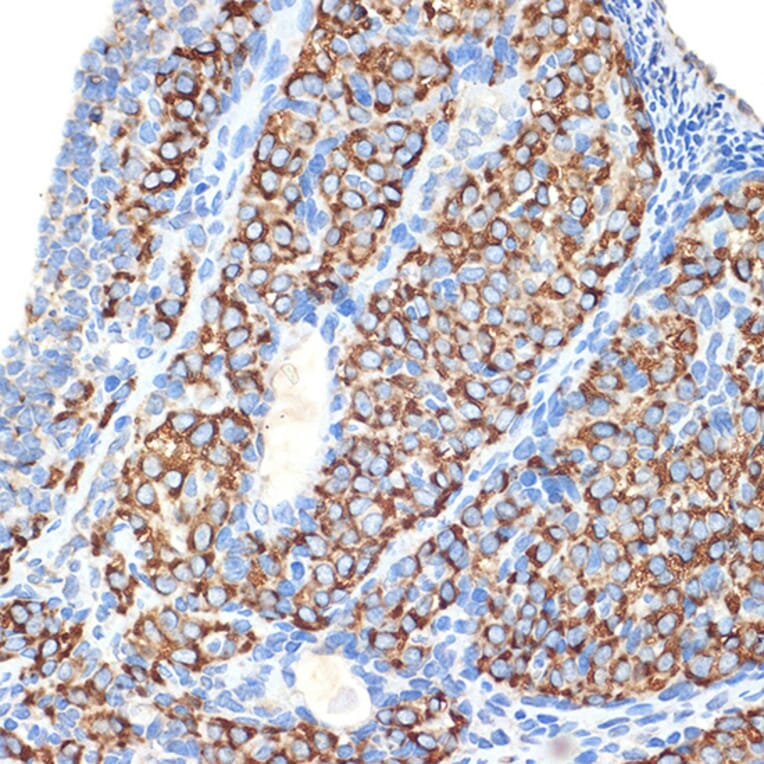 Immunohistochemistry - Anti-HSD3B1 Antibody [ARC2437] (A308449) - Antibodies.com