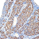 Immunohistochemistry - Anti-HSD3B1 Antibody [ARC2437] (A308449) - Antibodies.com