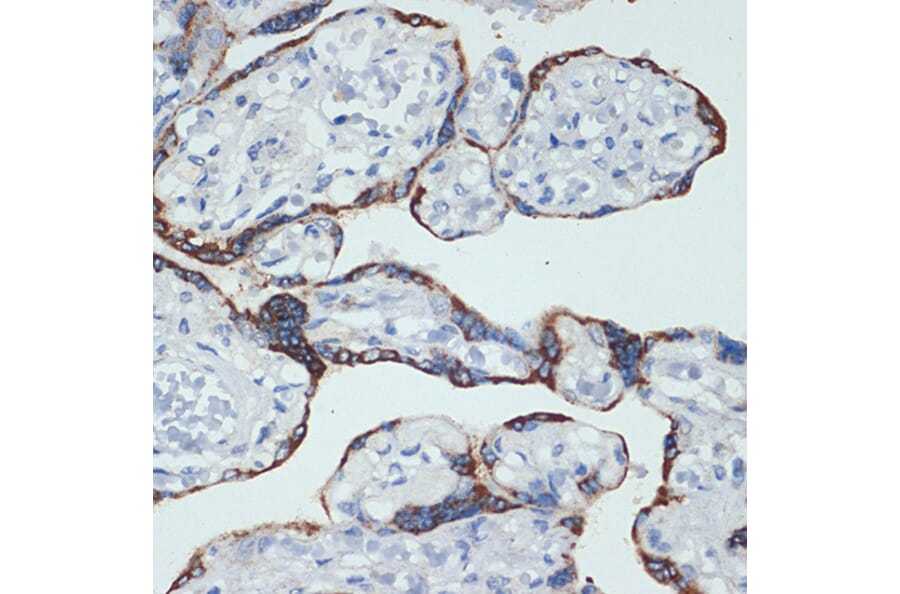 Immunohistochemistry - Anti-HSD3B1 Antibody [ARC2437] (A308449) - Antibodies.com