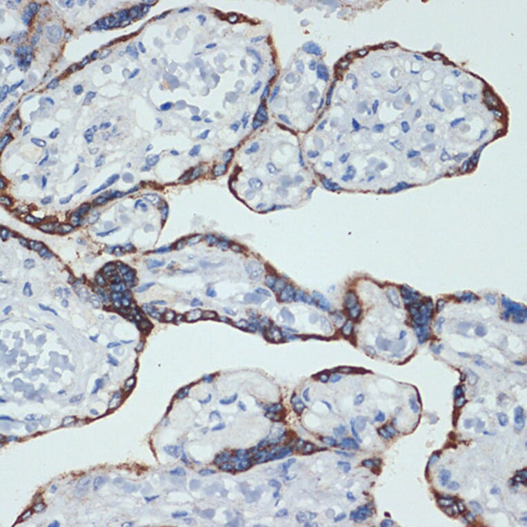 Immunohistochemistry - Anti-HSD3B1 Antibody [ARC2437] (A308449) - Antibodies.com