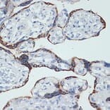 Immunohistochemistry - Anti-HSD3B1 Antibody [ARC2437] (A308449) - Antibodies.com