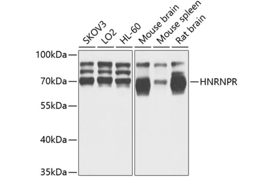 Western Blot - Anti-hnRNP R Antibody (A308450) - Antibodies.com