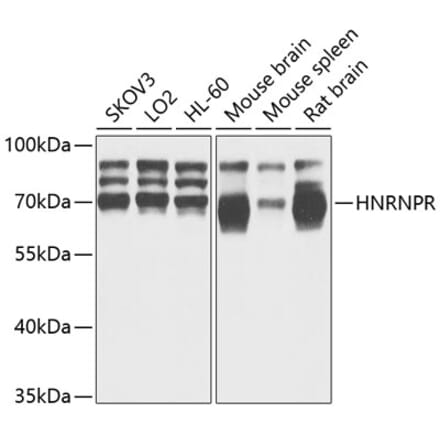 Western Blot - Anti-hnRNP R Antibody (A308450) - Antibodies.com