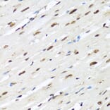 Immunohistochemistry - Anti-hnRNP R Antibody (A308450) - Antibodies.com