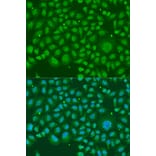 Immunofluorescence - Anti-hnRNP R Antibody (A308450) - Antibodies.com