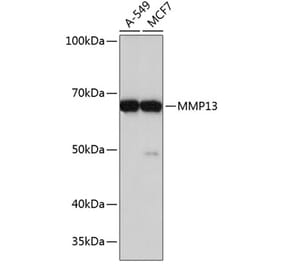 Western Blot - Anti-MMP13 Antibody [ARC0528] (A308452) - Antibodies.com