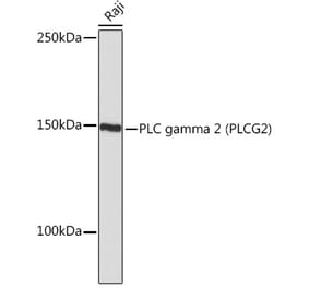 Western Blot - Anti-PLCG 2 Antibody [ARC1176] (A308453) - Antibodies.com