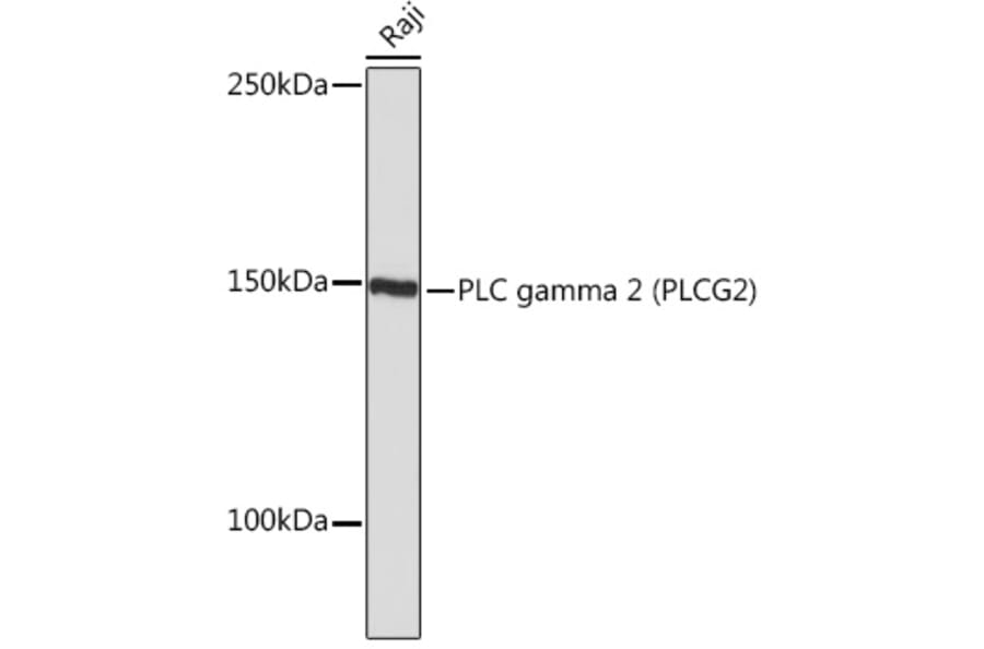 Western Blot - Anti-PLCG 2 Antibody [ARC1176] (A308453) - Antibodies.com