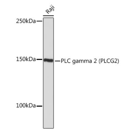 Western Blot - Anti-PLCG 2 Antibody [ARC1176] (A308453) - Antibodies.com