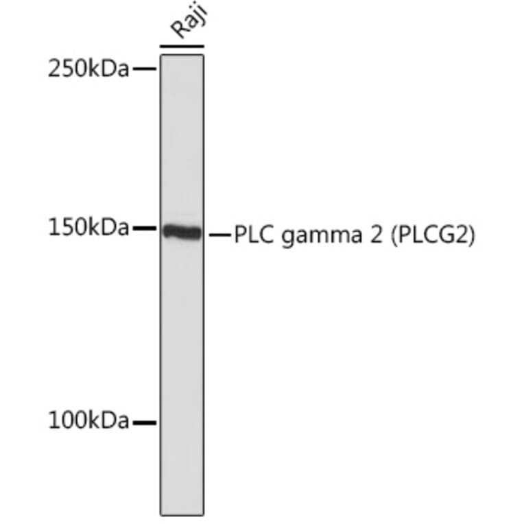 Western Blot - Anti-PLCG 2 Antibody [ARC1176] (A308453) - Antibodies.com