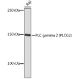 Western Blot - Anti-PLCG 2 Antibody [ARC1176] (A308453) - Antibodies.com