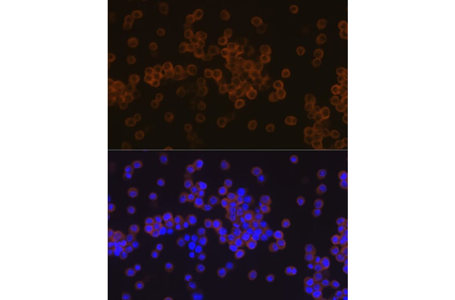 Immunofluorescence - Anti-PLCG 2 Antibody [ARC1176] (A308453) - Antibodies.com