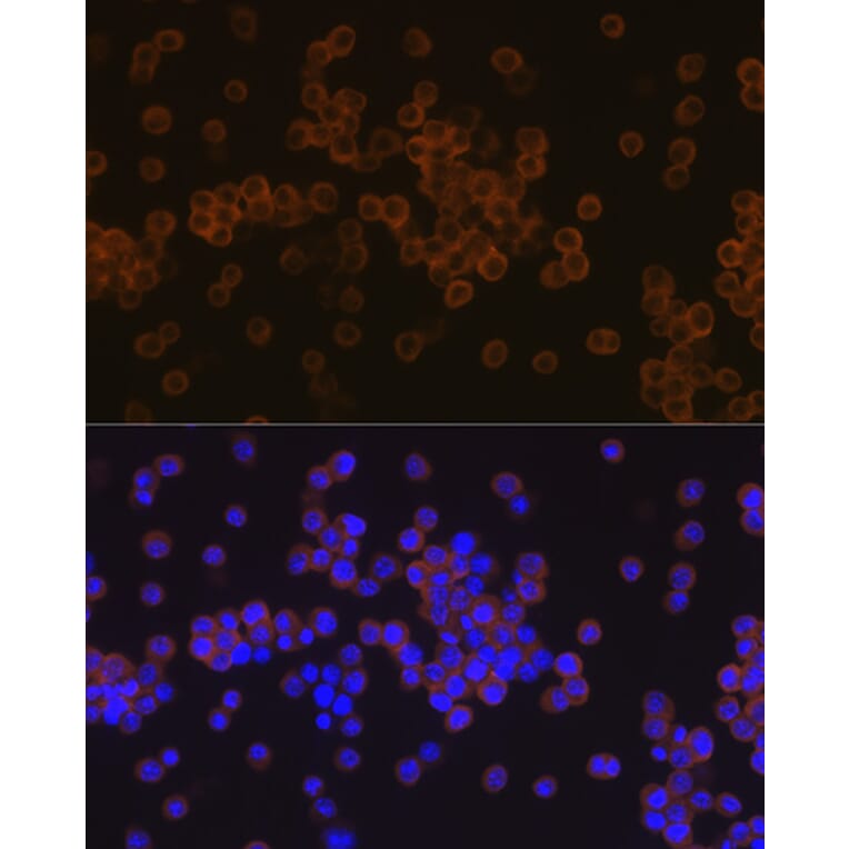 Immunofluorescence - Anti-PLCG 2 Antibody [ARC1176] (A308453) - Antibodies.com